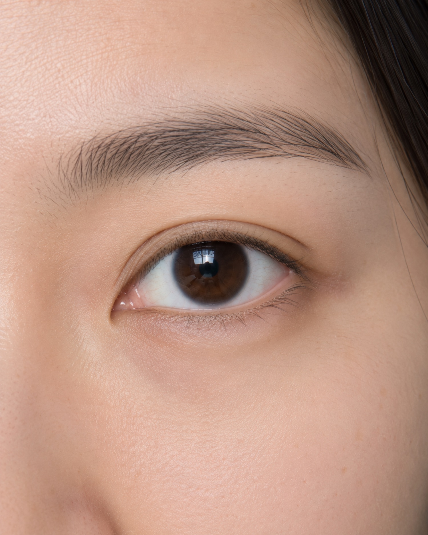 Eyes showing under-eye puffiness — the concern we address